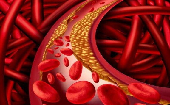 Sử dụng Diaglucon 4 có thể gây tăng cholesterol máu