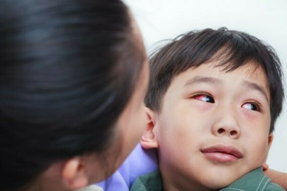 Viêm nội nhãn do nấm có thể gặp trên trẻ suy giảm miễn dịch.   Nguồn ảnh: Healthline