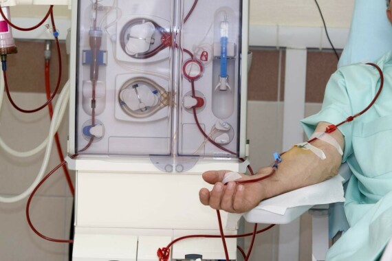 Lọc máu bằng chạy thận nhân tạo. Nguồn ảnh medicalnewstoday.com