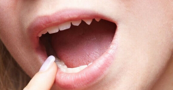 Khô miệng là một trong các tác dụng phụ khi dùng thuốc Degenvina