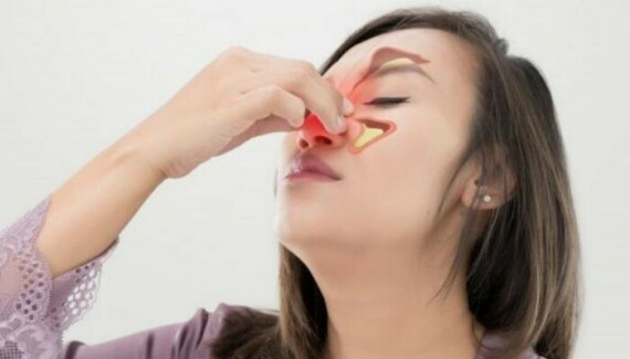 Desloderma điều trị làm giảm triệu chứng viêm mũi dị ứng