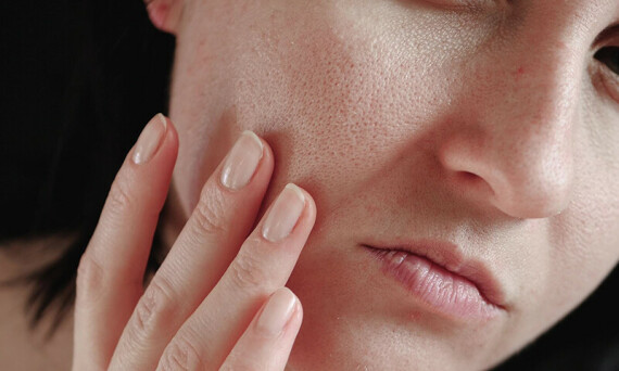 Khô da mùa đông phải làm thế nào - 6 bí quyết để có làn da ẩm mịn, không  bong tróc | MedlatecSử dụng Betasalic có thể gây ra tình trạng khô da