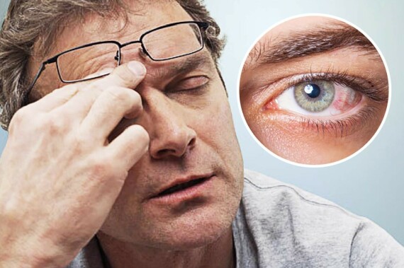 Có thể gặp tình trạng khô mắt sau khi sử dụng thuốc