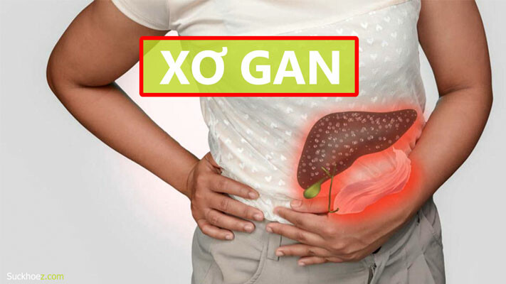 Bệnh xơ gan có nguy hiểm không?Thuốc thường được dùng hỗ trợ điều trị bệnh xơ gan