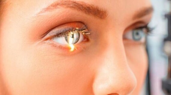 Dấu hiệu và triệu chứng bệnh Glaucoma | Bệnh viện Mắt quốc tế Hoàn MỹThuốc hỗ trợ điều trị giảm áp trong bệnh glaucoma