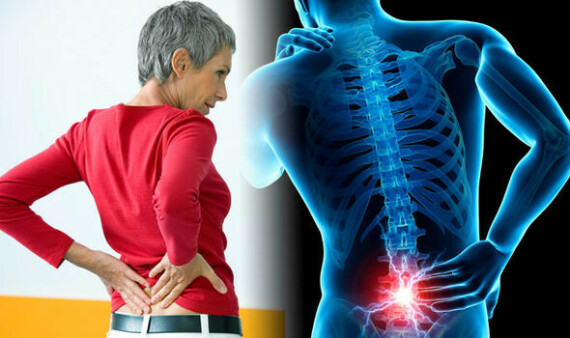 Hình: Thuốc được chỉ định giảm đau trong trường hợp đau lưng mạn tính do thoái hóa cột sống. Nguồn: Daily Express